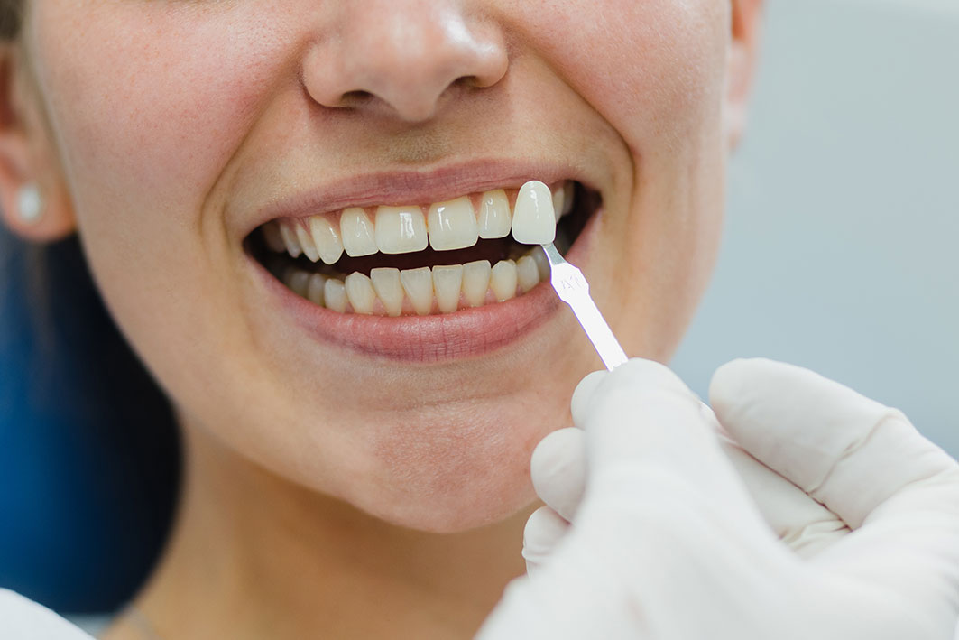 Zahnmedizin 2024: Trend in Richtung Ästhetik?